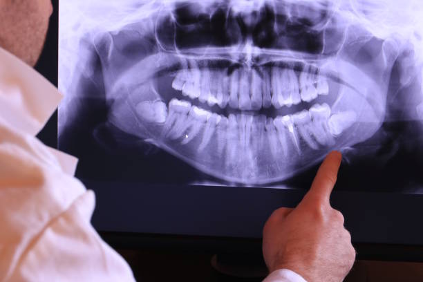 Best Lost Filling or Crown Replacement in New Baltimore, MI