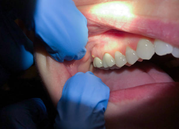 Best Urgent Dental Care for Toothaches in New Baltimore, MI