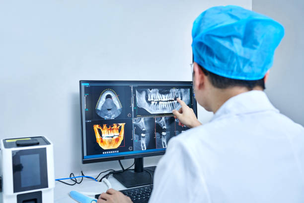 Best Emergency Wisdom Tooth Extraction in New Baltimore, MI